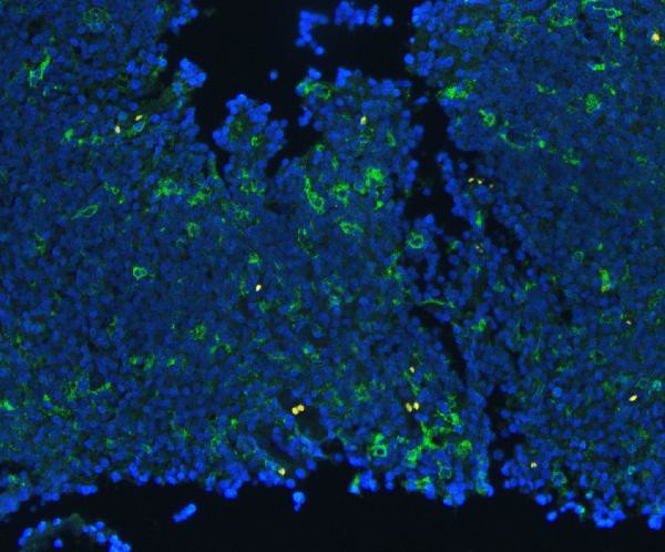 CD18 Antibody in Immunohistochemistry (Paraffin) (IHC (P))