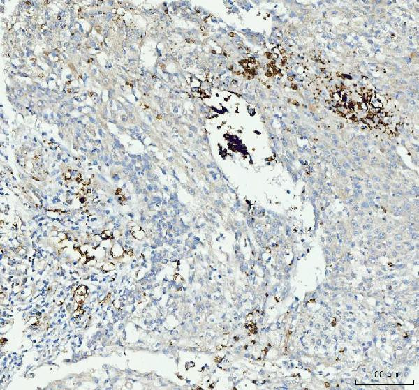 CD61 (Integrin beta 3) Antibody in Immunohistochemistry (Paraffin) (IHC (P))