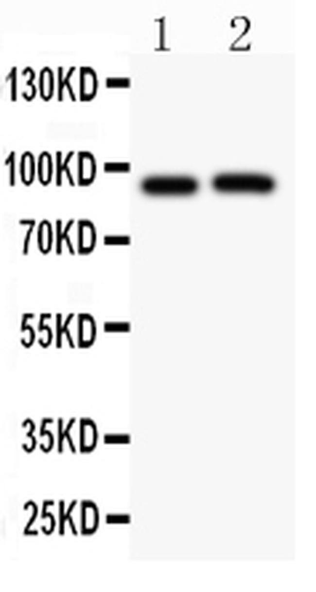 KV2.1 (KCNB1) Antibody in Western Blot (WB)