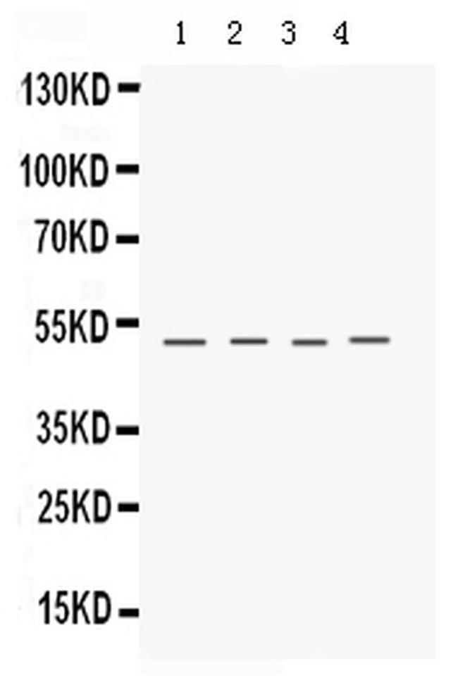 Keratocan Antibody in Western Blot (WB)