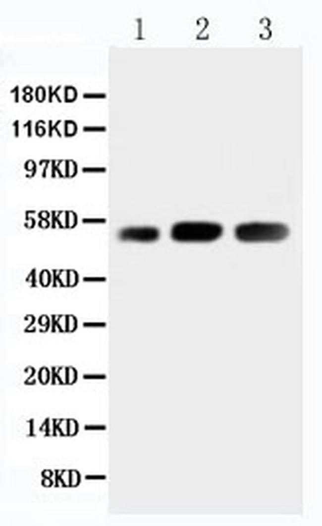 KIN Antibody in Western Blot (WB)