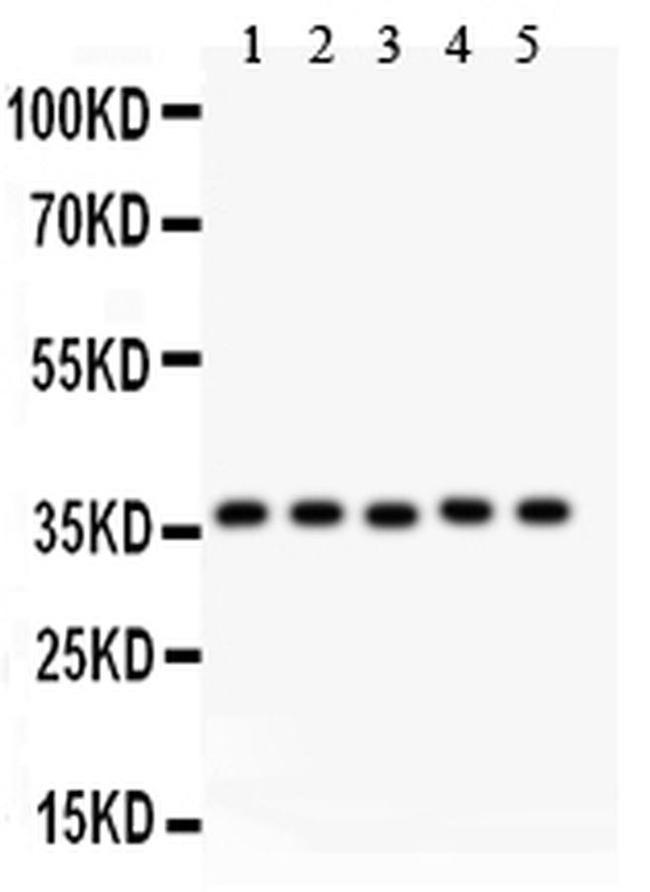 KLF6 Antibody in Western Blot (WB)