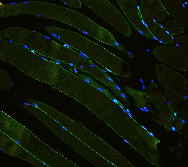 Laminin gamma-1,2,3 Antibody in Immunohistochemistry (Paraffin) (IHC (P))