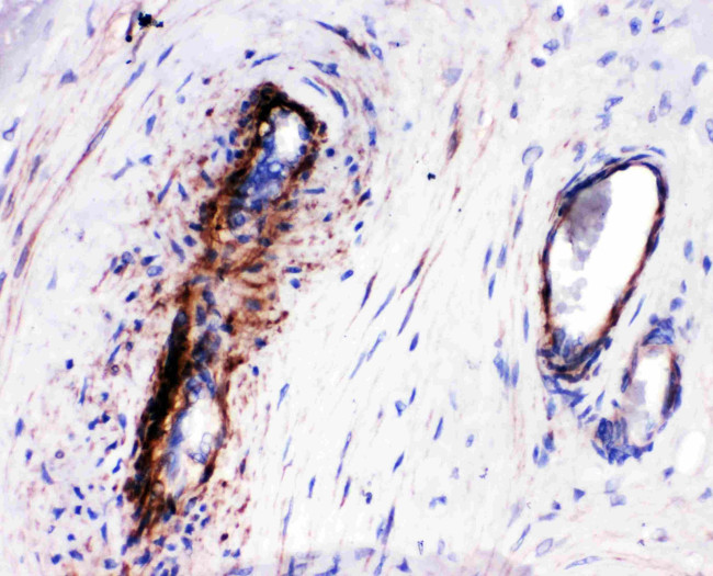 LASP1 Antibody in Immunohistochemistry (Paraffin) (IHC (P))