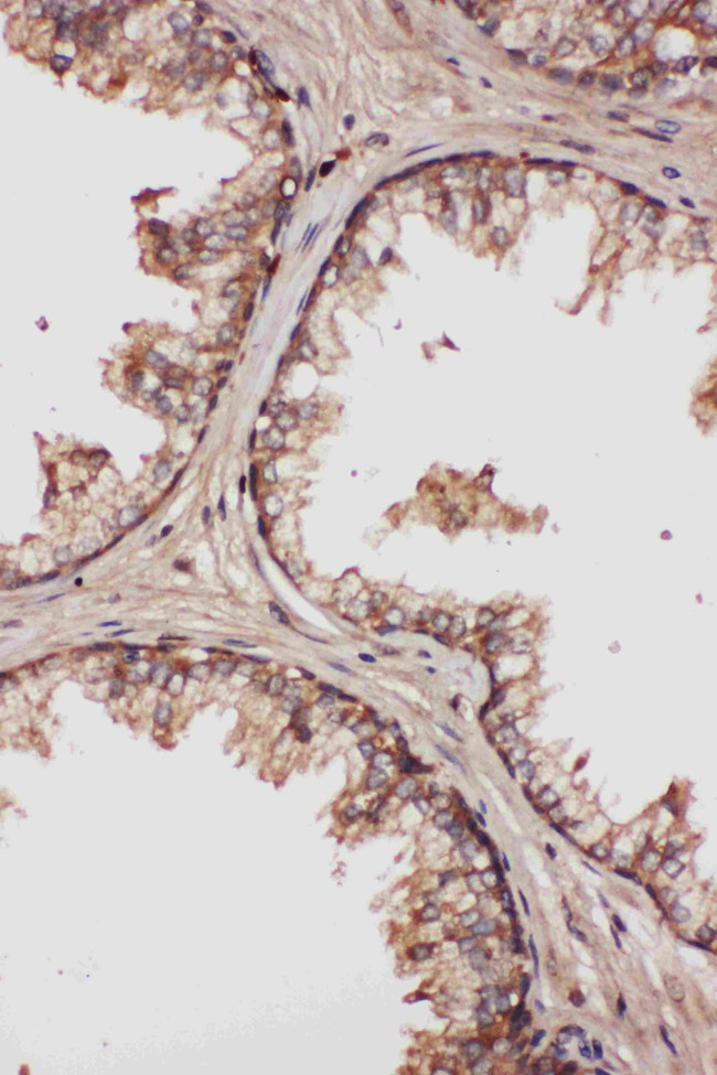 LCN1 Antibody in Immunohistochemistry (Paraffin) (IHC (P))