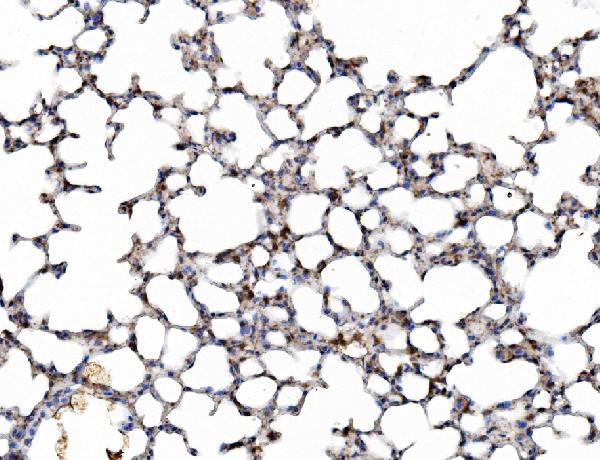 Galectin 3 Antibody in Immunohistochemistry (Paraffin) (IHC (P))