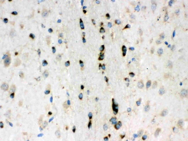 LUM Antibody in Immunohistochemistry (Paraffin) (IHC (P))
