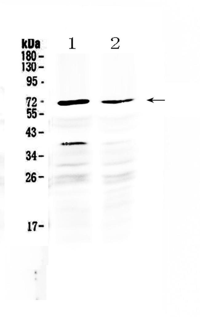 MAK Antibody in Western Blot (WB)