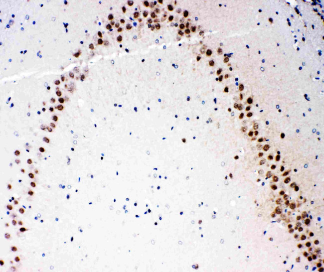 MEKK3 Antibody in Immunohistochemistry (Paraffin) (IHC (P))