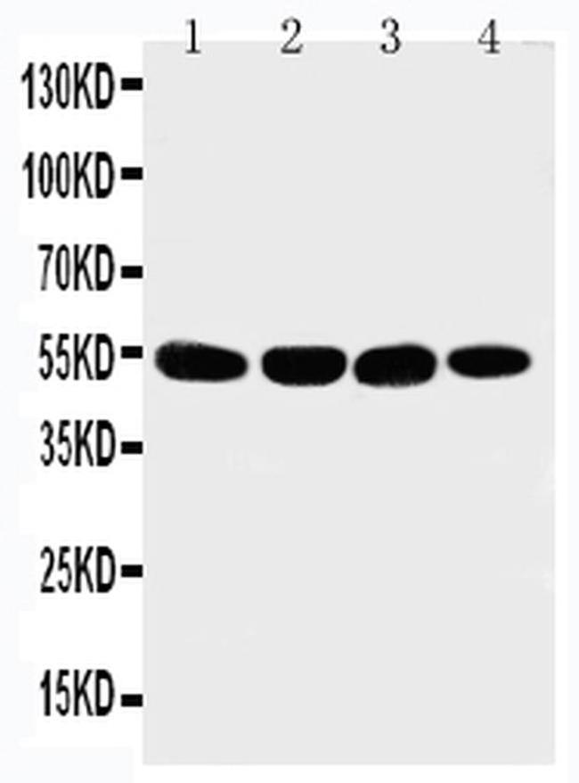 MATN3 Antibody in Western Blot (WB)