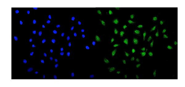 MED13 Antibody in Immunocytochemistry (ICC/IF)