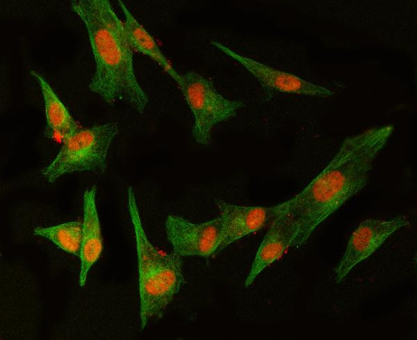 MED8 Antibody in Immunocytochemistry (ICC/IF)