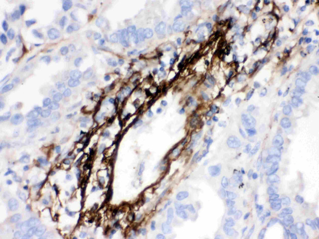MGP Antibody in Immunohistochemistry (Paraffin) (IHC (P))