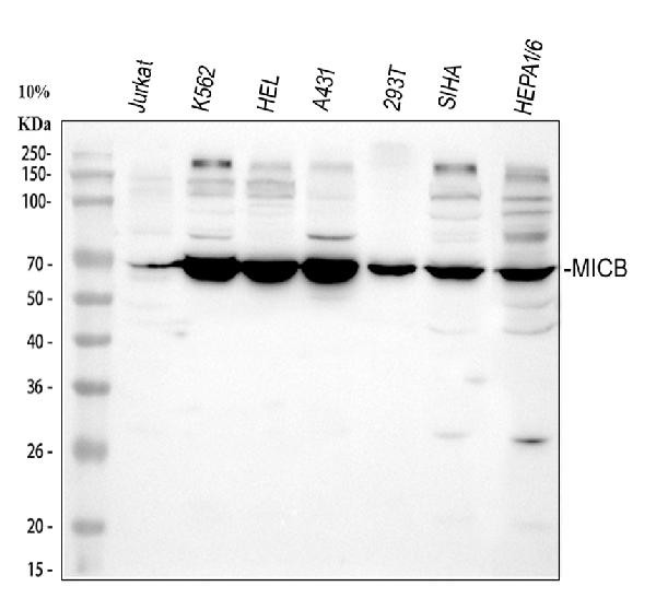 MICB Antibody in Western Blot (WB)