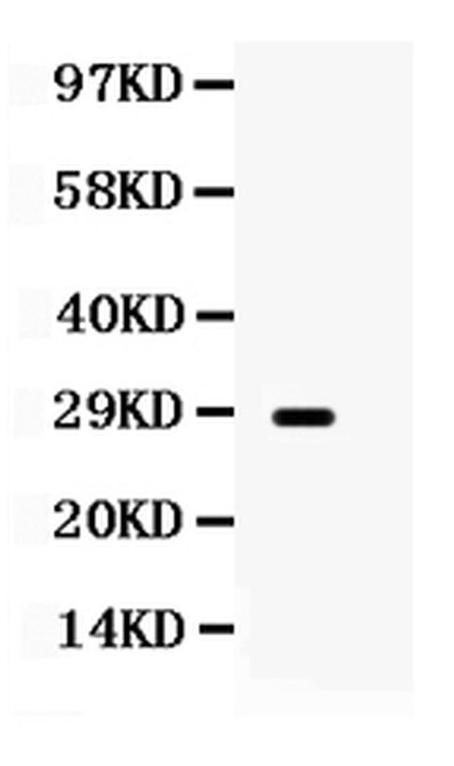Aquaporin 0 Antibody in Western Blot (WB)