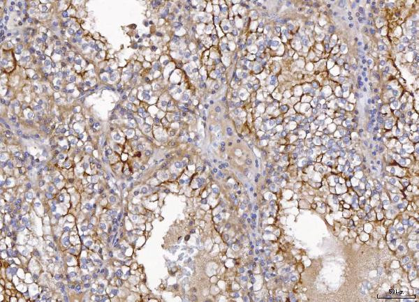 CD10 Antibody in Immunohistochemistry (Paraffin) (IHC (P))