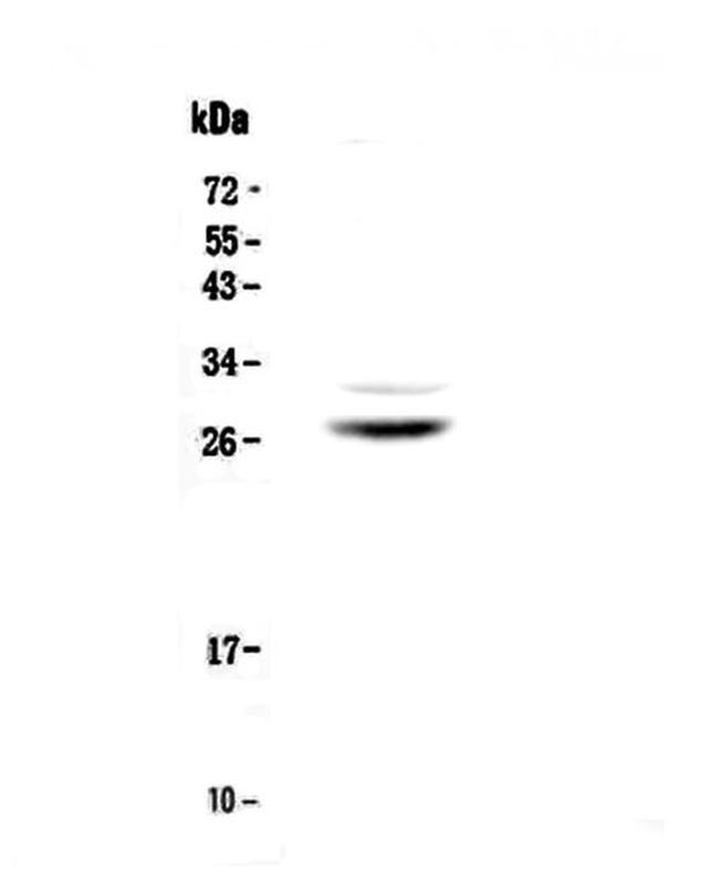 MPZ Antibody in Western Blot (WB)
