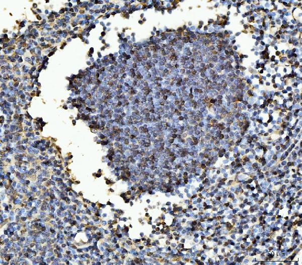B-Myb Antibody in Immunohistochemistry (Paraffin) (IHC (P))