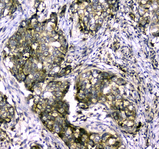 MYBPC3 Antibody in Immunohistochemistry (Paraffin) (IHC (P))
