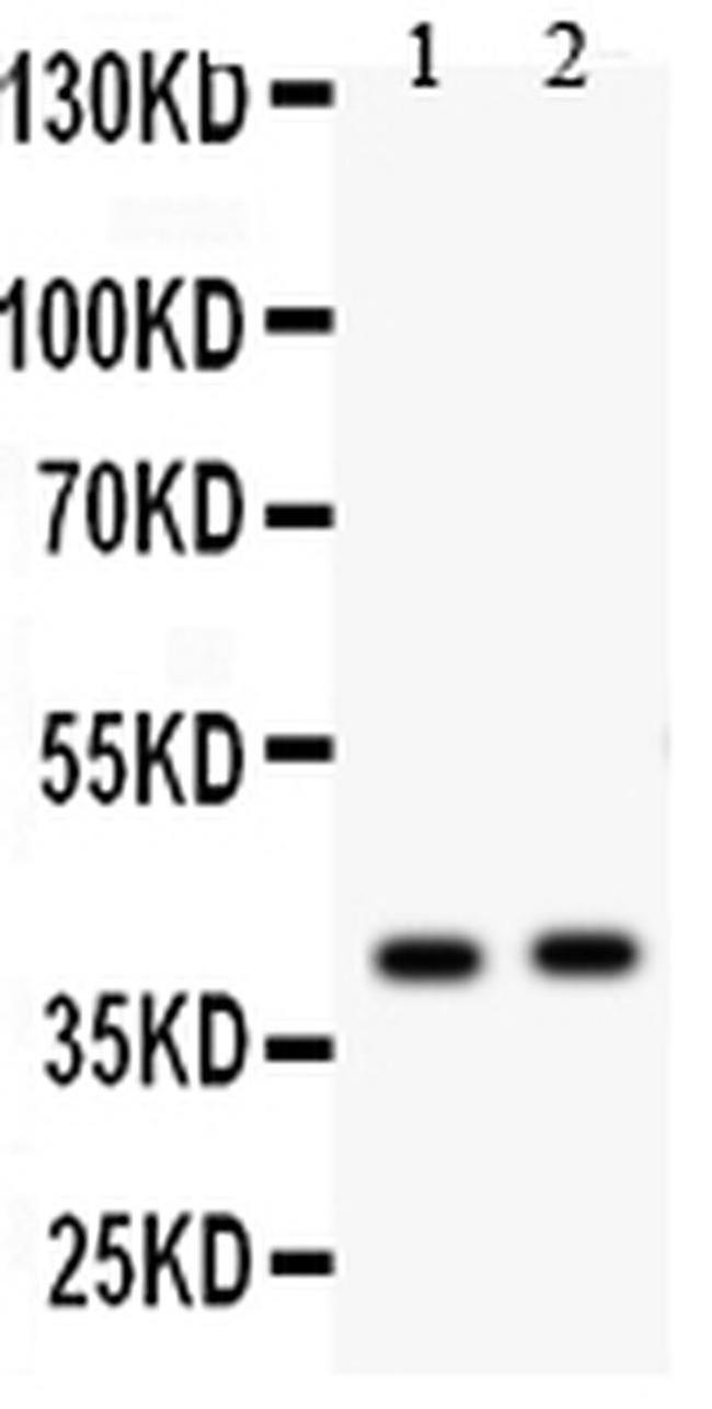 NDRG2 Antibody in Western Blot (WB)