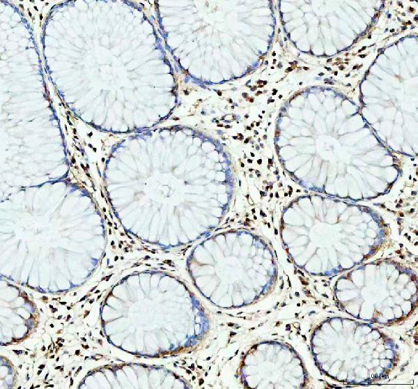 NLRP3 Antibody in Immunohistochemistry (Paraffin) (IHC (P))