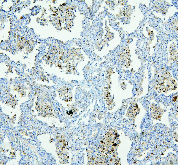 NLRP4G Antibody in Immunohistochemistry (Paraffin) (IHC (P))
