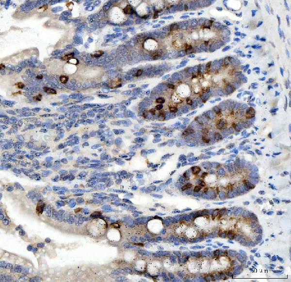 NOX1 Antibody in Immunohistochemistry (Paraffin) (IHC (P))