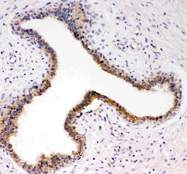 TrkC Antibody in Immunohistochemistry (Paraffin) (IHC (P))