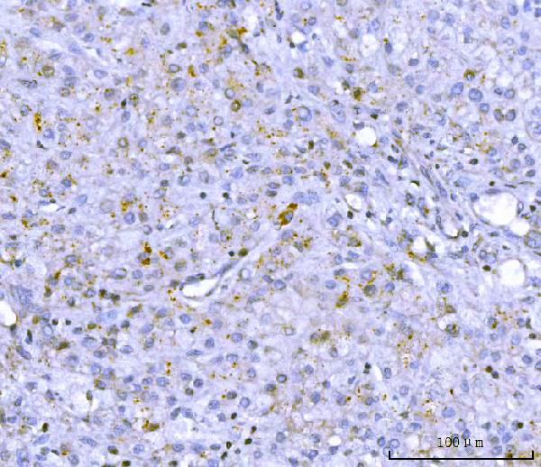 PCSK9 Antibody in Immunohistochemistry (Paraffin) (IHC (P))