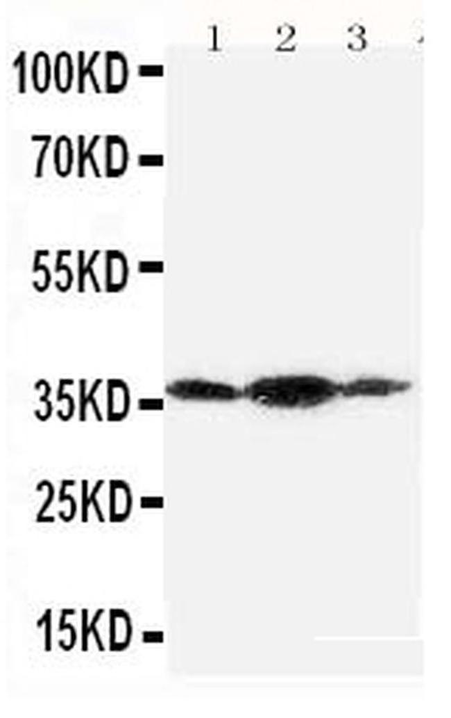 Podoplanin Antibody in Western Blot (WB)