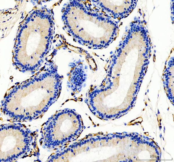 CD31 (PECAM-1) Antibody in Immunohistochemistry (Paraffin) (IHC (P))