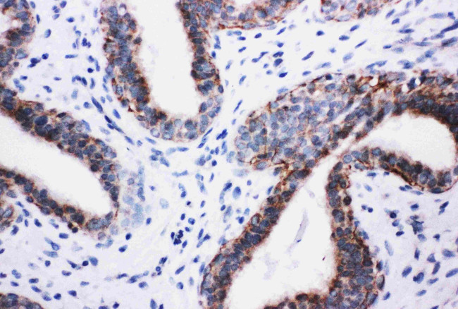 PIK3R2 Antibody in Immunohistochemistry (Paraffin) (IHC (P))