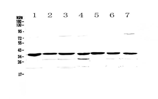 uPAR (CD87) Antibody in Western Blot (WB)