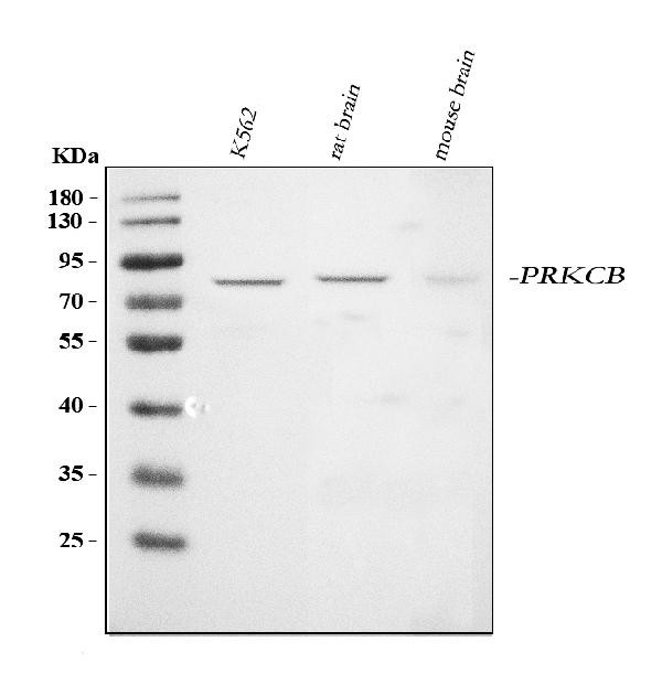 PKC beta-1 Antibody in Western Blot (WB)