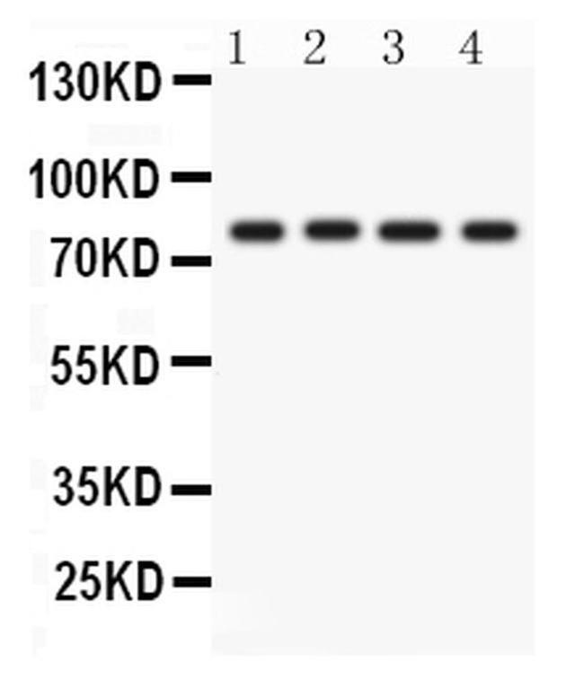 PKC eta Antibody in Western Blot (WB)