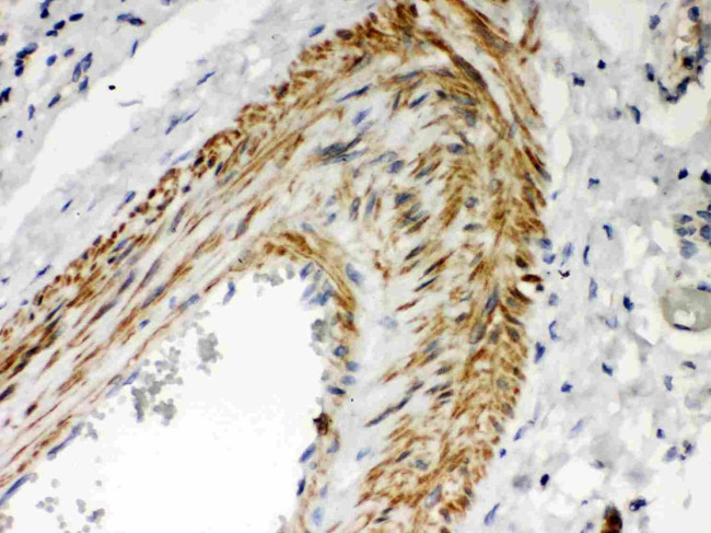PKC lambda/iota Antibody in Immunohistochemistry (Paraffin) (IHC (P))