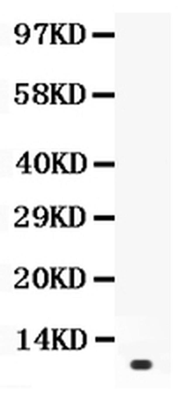 Prolactin Antibody in Western Blot (WB)