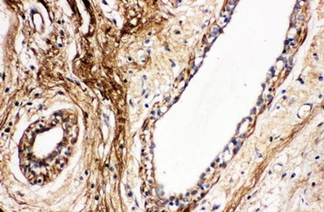Protein C Antibody in Immunohistochemistry (Paraffin) (IHC (P))