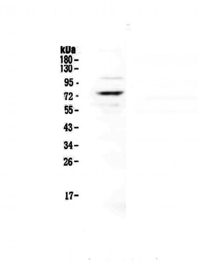 Protein S Antibody in Western Blot (WB)