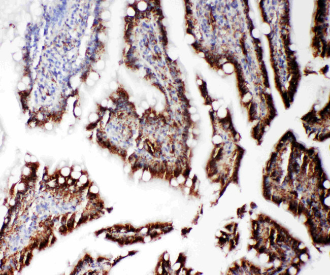 RGS3 Antibody in Immunohistochemistry (Paraffin) (IHC (P))