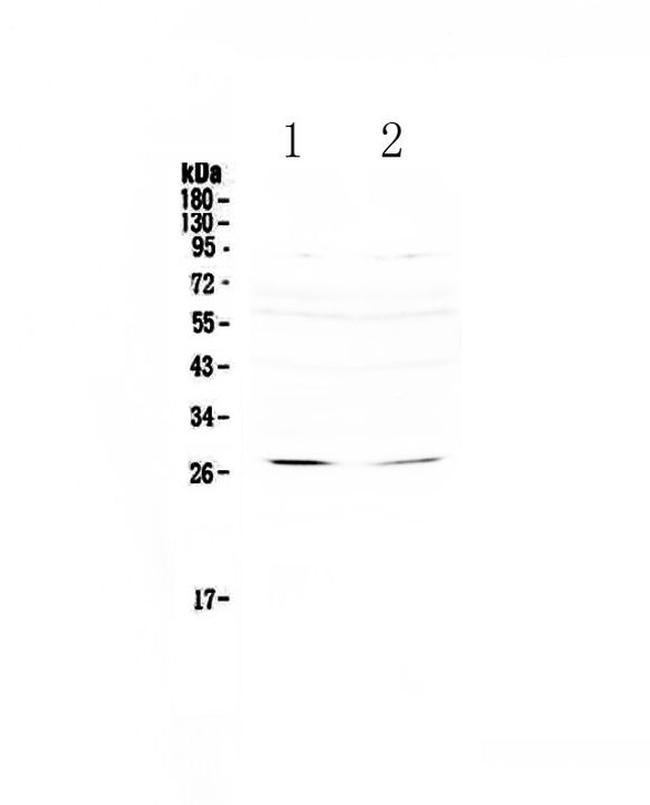 RNF186 Antibody in Western Blot (WB)