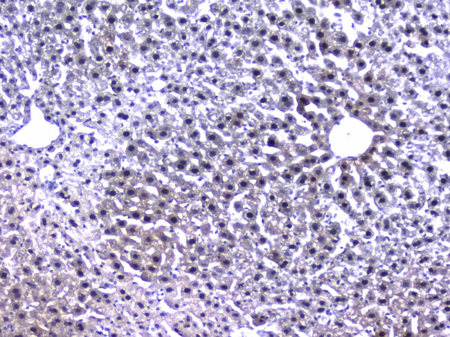 RXRA Antibody in Immunohistochemistry (Paraffin) (IHC (P))