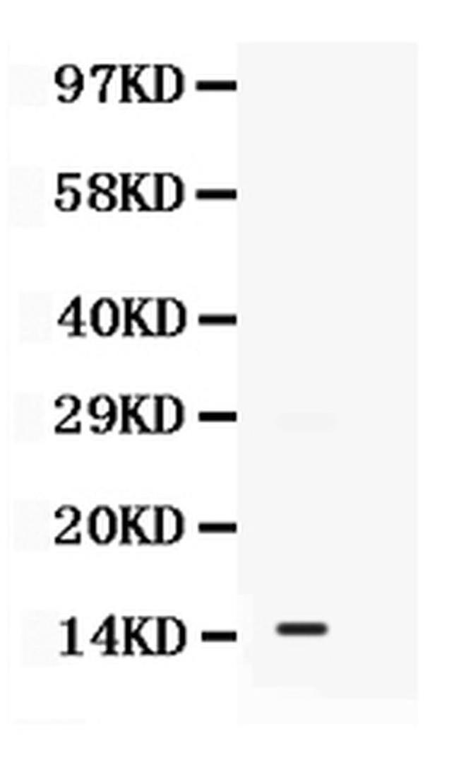 S100A11 Antibody in Western Blot (WB)