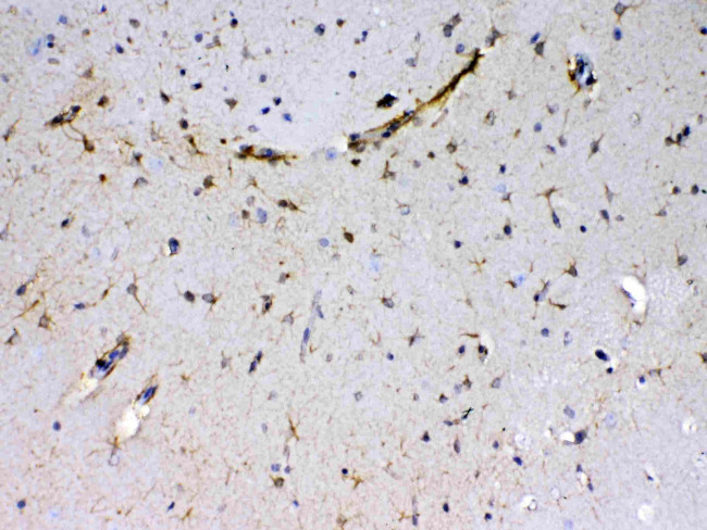 Sacsin Antibody in Immunohistochemistry (Paraffin) (IHC (P))