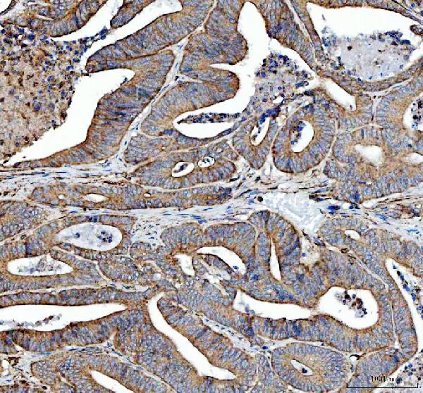 SDHA Antibody in Immunohistochemistry (Paraffin) (IHC (P))