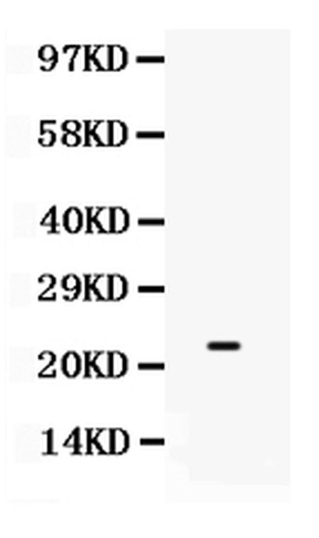 SECTM1 Antibody in Western Blot (WB)