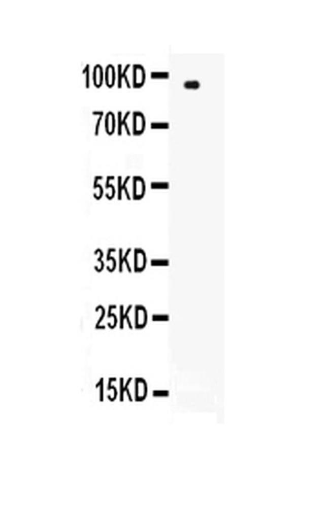 L-Selectin (CD62L) Antibody in Western Blot (WB)