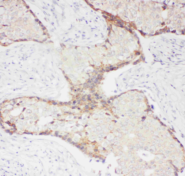 P-Selectin (CD62P) Antibody in Immunohistochemistry (Paraffin) (IHC (P))