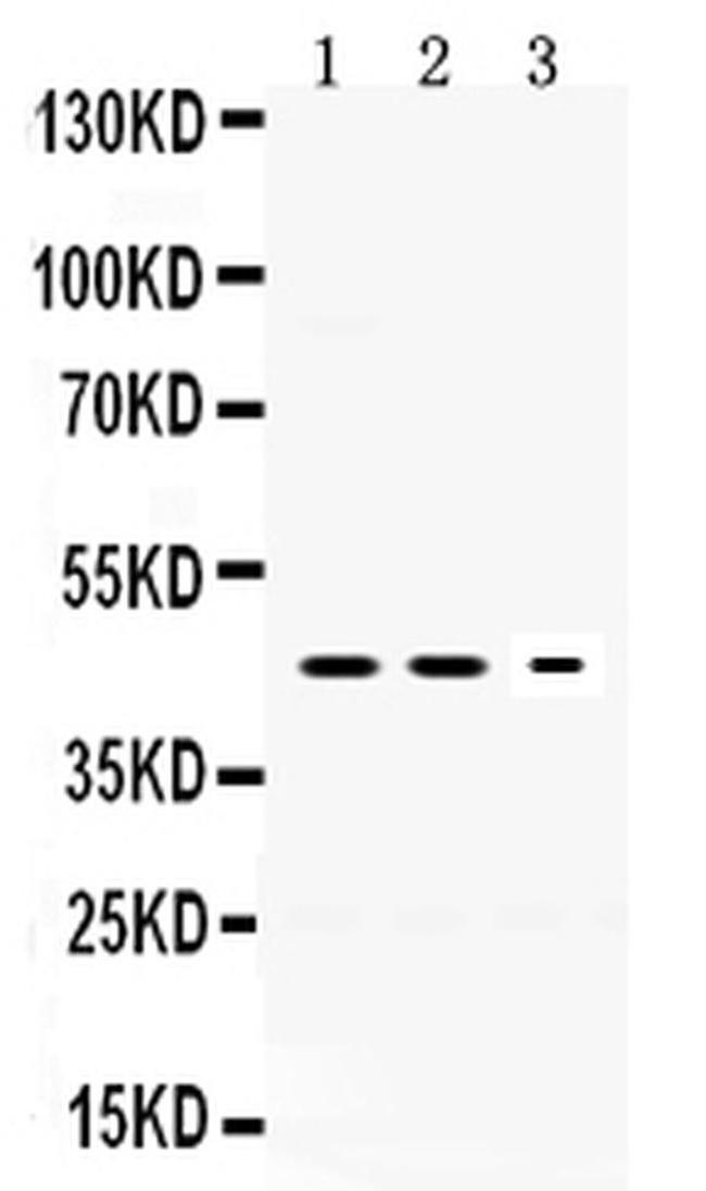 Neuroserpin Antibody in Western Blot (WB)