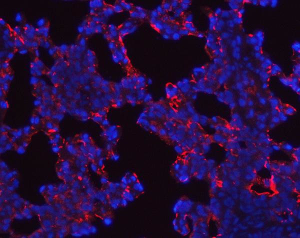 SFTPA1/SFTPA2 Antibody in Immunohistochemistry (Paraffin) (IHC (P))